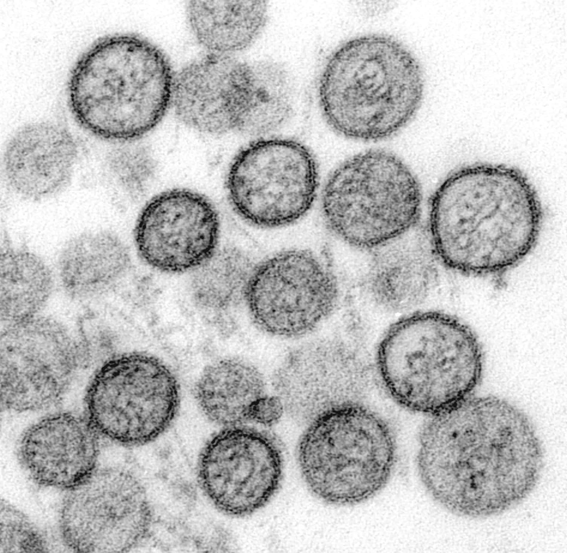 Transmissionselektronenmikroskopische Aufnahme des Sin-Nombre-Virus (ein spezifischer Vertreter der Hantaviren).